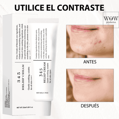 ReparaDerm™ | Crema para Marcas de Acné